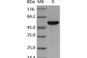 Western Blotting (WB) image for C-Mer Proto-Oncogene Tyrosine Kinase (MERTK) protein (GST tag,His tag) (ABIN7317111) (MERTK Protein (GST tag,His tag))