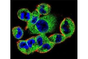 Confocal immunofluorescent analysis of SOCS4 antibody with A2058 cells followed by Alexa Fluor 488-conjugated goat anti-rabbit lgG (green). (SOCS4 antibody  (AA 227-254))