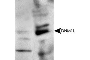 Western blot analysis with DNM1L polyclonal antibody  at 1 : 500x dilution. (Dynamin 1-Like antibody  (AA 500-600))