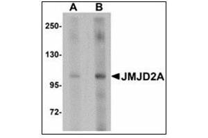 Western blot analysis of JMJD2A in rat liver tissue lysate with JMJD2A antibody at (A) 1 and (B) 2 µg/ml. (KDM4A antibody)