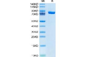 Factor XI Protein (AA 19-625) (His tag)