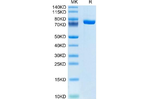 Factor XI Protein (AA 19-625) (His tag)