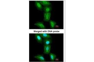 ICC/IF Image Immunofluorescence analysis of paraformaldehyde-fixed A549, using PSMC5, antibody at 1:200 dilution. (PSMC5 antibody  (Center))