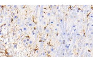 Detection of GFAP in Mouse Spinal cord Tissue using Monoclonal Antibody to Glial Fibrillary Acidic Protein (GFAP) (GFAP antibody  (AA 70-374))