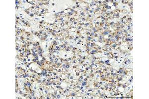 IHC analysis of ABCB4 using anti-ABCB4 antibody (ABIN3043734). (ABCB4 antibody  (AA 601-720))