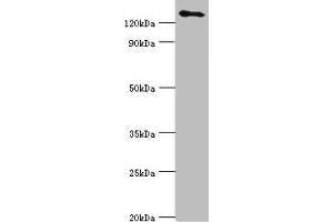 Western blot All lanes: USP8 antibody at 14 μg/mL + 293T whole cell lysate Secondary Goat polyclonal to rabbit IgG at 1/10000 dilution Predicted band size: 128, 116 kDa Observed band size: 128 kDa (USP8 antibody  (C-Term))
