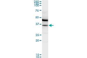 MDH2 monoclonal antibody (M01), clone 1G12. (MDH2 antibody  (AA 134-246))