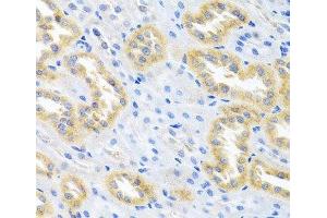 Immunohistochemistry of paraffin-embedded Rat kidney using BMP3 Polyclonal Antibody at dilution of 1:100 (40x lens). (BMP3 antibody)