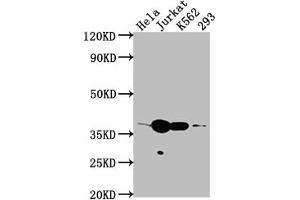 Western Blot Positive WB detected in: Hela whole cell lysate, Jurkat whole cell lysate, K562 whole cell lysate, 293 whole cell lysate All lanes: CDK6 antibody at 1:2000 Secondary Goat polyclonal to rabbit IgG at 1/50000 dilution Predicted band size: 37 kDa Observed band size: 37 kDa (Recombinant CDK6 antibody)