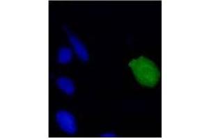 Immunofluorescence (IF) image for anti-Human Papilloma Virus 18 E7 (HPV-18 E7) (AA 1-35), (N-Term) antibody (ABIN781779) (HPV18 E7 antibody  (N-Term))