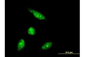 Immunofluorescence of monoclonal antibody to PHF5A on HeLa cell. (PHF5A antibody  (AA 1-110))