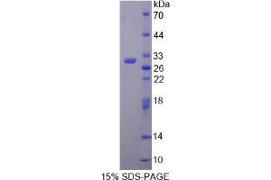 Image no. 1 for Pyruvate Dehydrogenase Complex, Component X (PDHX) (AA 222-471) protein (His tag) (ABIN4990697) (PDHX Protein (AA 222-471) (His tag))