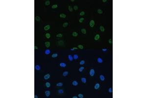 Immunofluorescence analysis of U-2 OS cells using GTF2E1 Polyclonal Antibody (ABIN7267371) at dilution of 1:100 (40x lens). (GTF2E1 antibody  (AA 230-439))