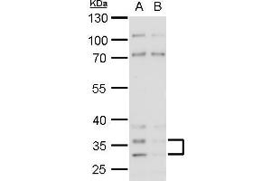 WB Image Histamine H4 Receptor antibody detects Histamine H4 Receptor protein by western blot analysis. (HRH4 antibody  (N-Term))