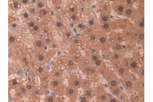 Detection of SDH in Rat Liver Tissue using Polyclonal Antibody to Sorbitol Dehydrogenase (SDH) (SORD antibody  (AA 2-357))