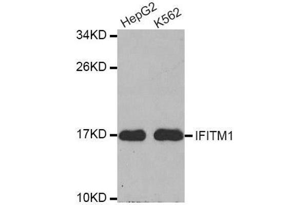 IFITM1 antibody  (C-Term)