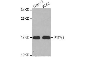 Western blot analysis of extracts of various cell lines, using IFITM1 antibody. (IFITM1 antibody  (C-Term))