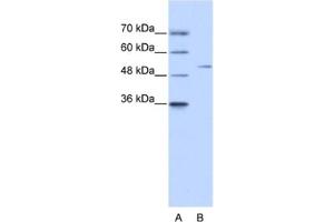 Western Blotting (WB) image for anti-Zinc Finger Protein 555 (ZNF555) antibody (ABIN2461313) (ZNF555 antibody)