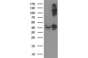 Image no. 2 for anti-Pantothenate Kinase 3 (PANK3) antibody (ABIN1500028) (PANK3 antibody)
