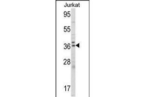 Western blot analysis of ALAD Antibody in Jurkat cell line lysates (35ug/lane) (ALAD antibody  (C-Term))