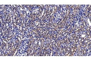 Immunohistochemistry (IHC) image for anti-DEAD (Asp-Glu-Ala-Asp) Box Polypeptide 58 (DDX58) (AA 550-776) antibody (ABIN7433744)