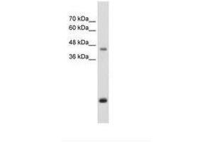 Image no. 2 for anti-Asporin (ASPN) (AA 250-299) antibody (ABIN203462) (Asporin antibody  (AA 250-299))