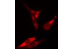 ABIN6266692 staining HeLa cells by IF/ICC.