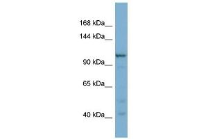 COPG2 antibody used at 1 ug/ml to detect target protein. (COPG2 antibody  (N-Term))