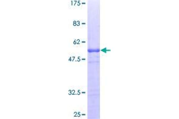 Amyloid beta (A4) Precursor Protein-Binding, Family B, Member 1 Interacting Protein (APBB1IP) (AA 1-172) protein (GST tag)