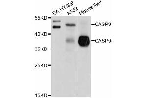 Western blot analysis of extracts of various cell lines, using CASP9 antibody (ABIN5995675) at 1/1000 dilution. (Caspase 9 antibody)