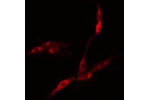 ABIN6275121 staining COLO205 cells by IF/ICC. (EIF3F antibody  (Internal Region))