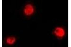 Immunofluorescent analysis of PRDM7 staining in A549 cells. (PRDM7 antibody)