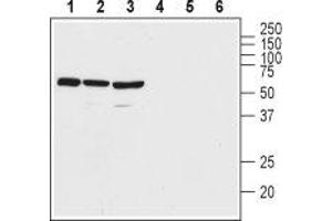 Western blot analysis of rat brain lysate (lanes 1 and 4), mouse brain lysate (lanes 2 and 5), and human Malme-3M melanoma cell lysate (lanes 3 and 6): - 1-3. (VIPR2 antibody  (Extracellular, N-Term))