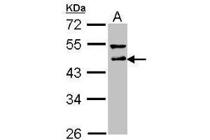 WB Image Sample (30 ug of whole cell lysate) A: A431 , 10% SDS PAGE antibody diluted at 1:1000