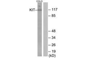 Western blot analysis of extracts from COLO205 cells, using KIT (Ab-936) Antibody. (KIT antibody  (AA 906-955))