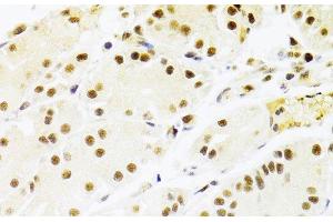 Immunohistochemistry of paraffin-embedded Human stomach using RBPJ Polyclonal Antibody at dilution of 1:100 (40x lens). (RBPJ antibody)