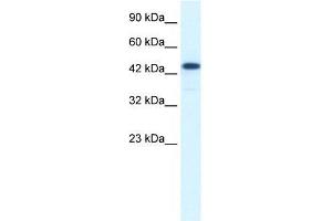Human Jurkat; WB Suggested Anti-RCOR3 Antibody Titration: 1.