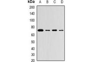 Western blot analysis of ZNF145 expression in Hela (A), THP1 (B), mouse lung (C), mouse brain (D) whole cell lysates. (ZBTB16 antibody)