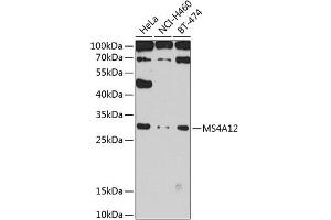 Western blot analysis of extracts of various cell lines, using MS4 antibody (ABIN6131373, ABIN6144052, ABIN6144053 and ABIN6224244) at 1:1000 dilution. (MS4A12 antibody  (AA 1-90))