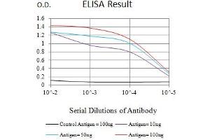 Black line: Control Antigen (100 ng),Purple line: Antigen (10 ng), Blue line: Antigen (50 ng), Red line:Antigen (100 ng) (CCR6 antibody)