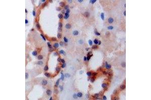 Immunohistochemical analysis of PIST staining in mouse kidney formalin fixed paraffin embedded tissue section. (GOPC antibody)