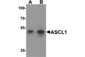 Western blot analysis of ACSL1 in human lung tissue lysate with ACSL1 Antibody  at (A) 1 and (B) 2 μg/ml. (ACSL1 antibody  (Middle Region))