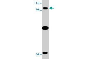 Western blot analysis of TLR6 expression in Jurkat cell lysate with TLR6 polyclonal antibody  at 2 ug/mL . (TLR6 antibody  (N-Term))