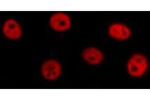 Immunofluorescence (fixed cells) (IF/ICC) image for anti-Core-Binding Factor, beta Subunit (CBFB) (N-Term) antibody (ABIN6257985)