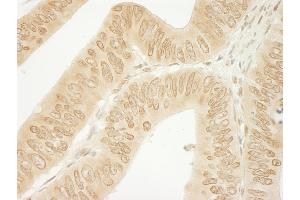 Immunohistochemistry (IHC) image for anti-Catenin (Cadherin-Associated Protein), delta 1 (CTNND1) (AA 625-675) antibody (ABIN7454382)