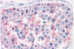 Human Testis: Formalin-Fixed, Paraffin-Embedded (FFPE) (ENPP3 antibody  (Internal Region))