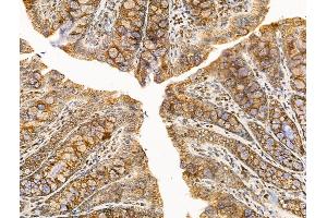 ABIN7094741 and ABIN7098792 at 1/100 staining Rat colorectal tissue by IHC-P.