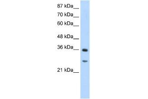 WB Suggested Anti-GIPC2 Antibody Titration:  1. (GIPC2 antibody  (N-Term))