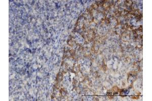 Immunoperoxidase of monoclonal antibody to SNAPIN on formalin-fixed paraffin-embedded human tonsil. (SNAPIN antibody  (AA 41-136))