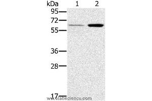 Western blot analysis of Human liver and mouse kidney tissue, using TNFRSF11A Polyclonal Antibody at dilution of 1:200